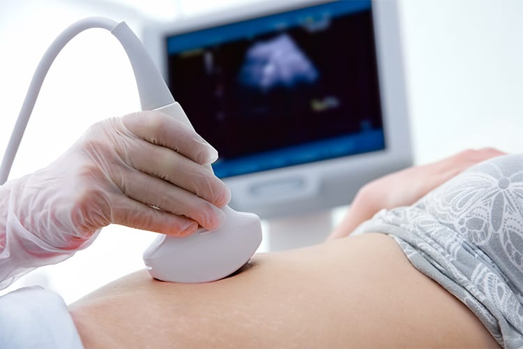 Woman having an ultrasound scan before egg retrieval as a part of an IVF procedure