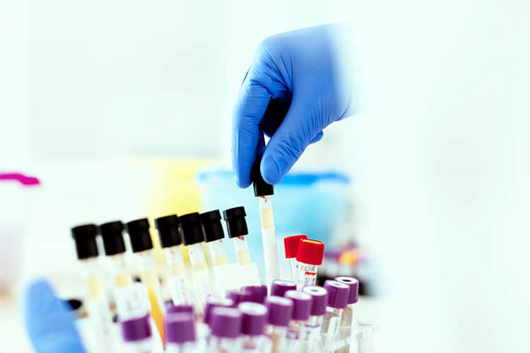DNA tests can reveal relations between donor-conceived children, the donor and siblings