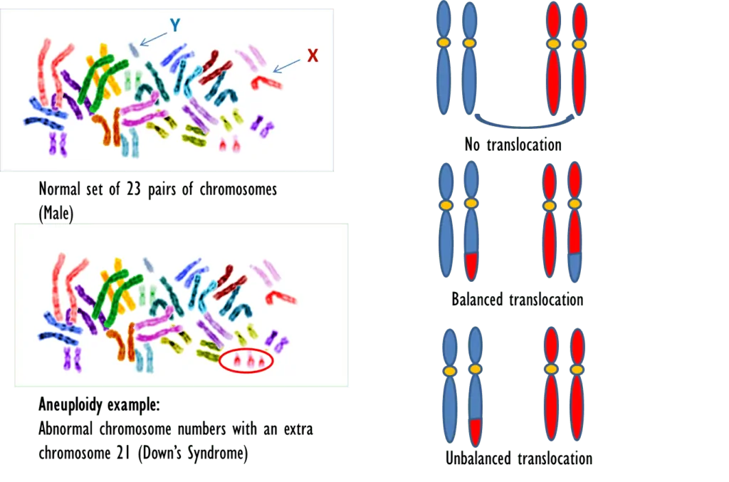 aneuploidy and translocation