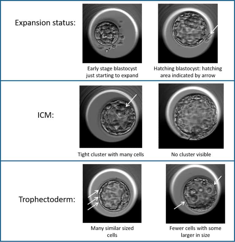 Blastocysts in a microscope