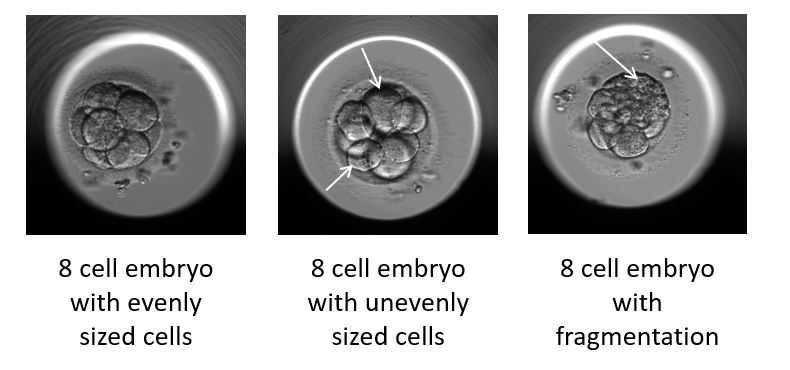 Three different embryo cells in a microscope